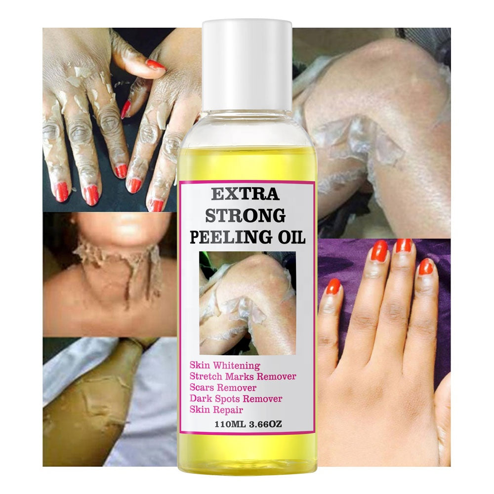 ÓLEO PEELING EXTRA FORTE