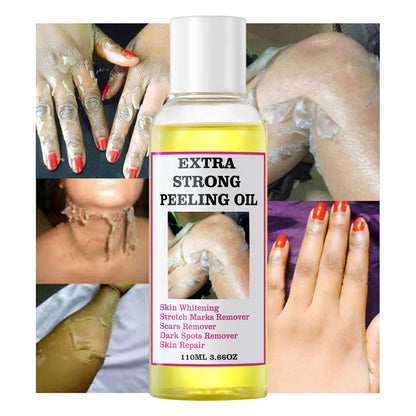 ÓLEO PEELING EXTRA FORTE