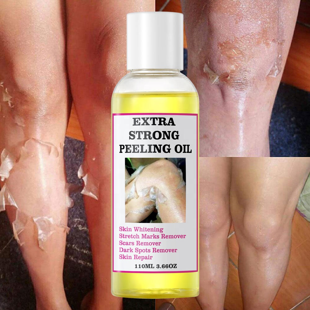 ÓLEO PEELING EXTRA FORTE
