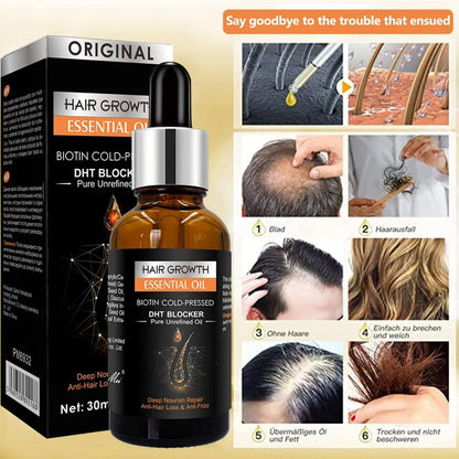 Hair Growth Essential Oil- Óleo Essencial para Crescimento Capilar 🌿