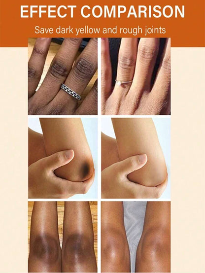 Dark Knuckle Whitening Lotion- Creme clareador